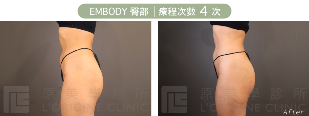 embody增肌減脂臀部