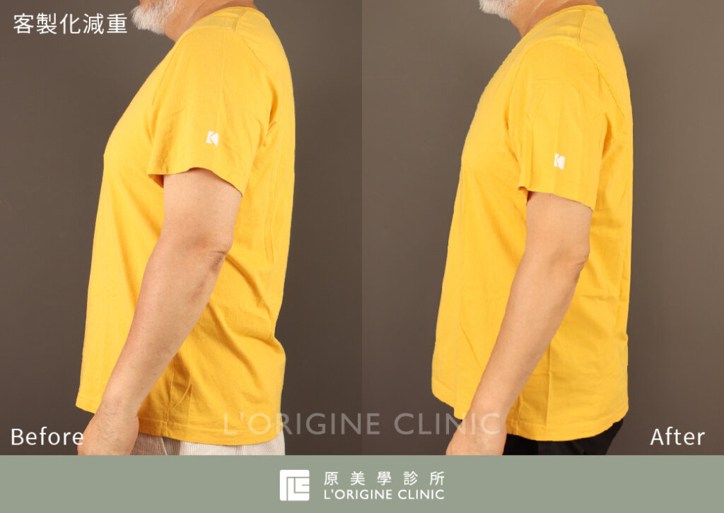 劉亮佐 療程前後對比