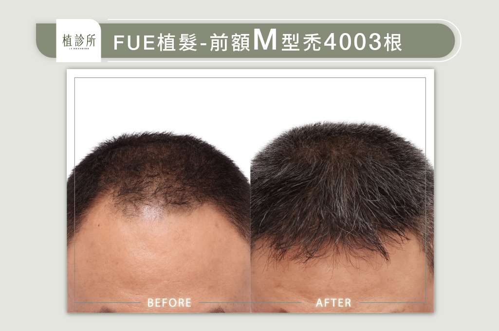 官網陳燕萍醫生案例圖-何松豫2-1