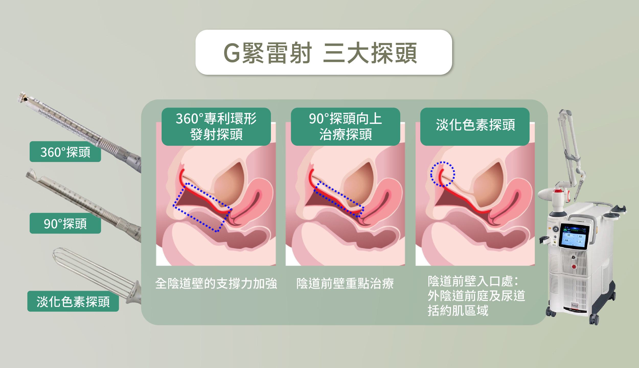 Ｇ緊雷射三大探頭