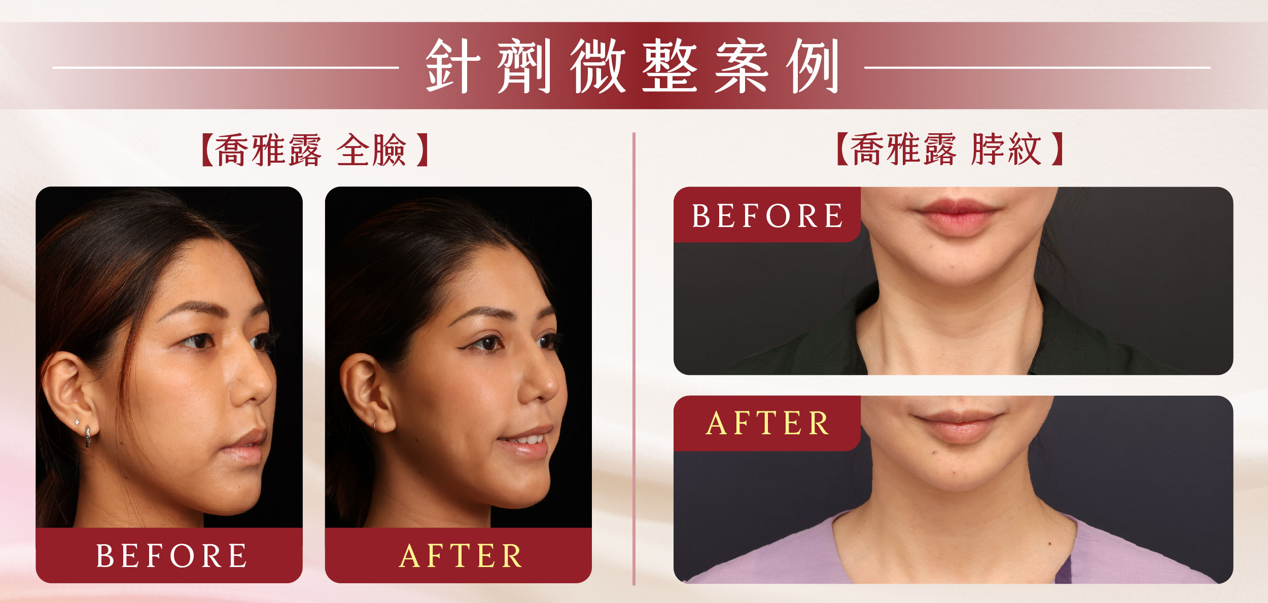 母親節landing page_針劑_BA