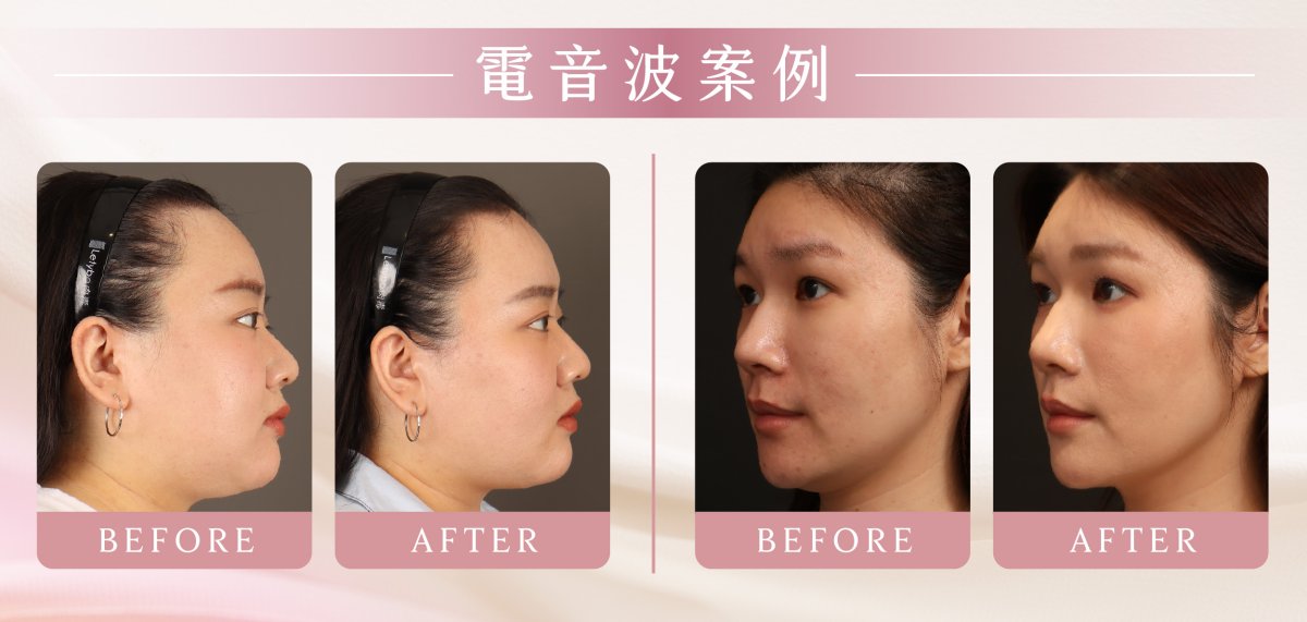 母親節landing page02_BA-0001