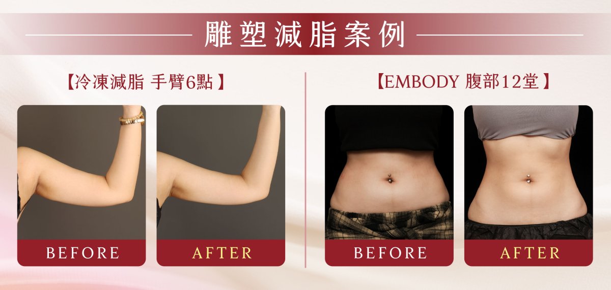 母親節landing page_體雕_BA