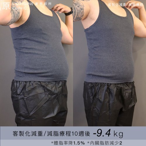 減重案例-BA-鐵牛_0